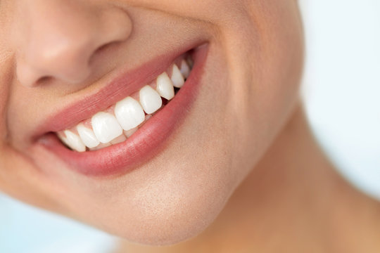 Comparing the Top 5 Teeth Whitening Products for a Brighter Smile